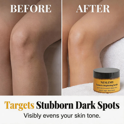🏆 LIMITED-TIME 50% OFF! ✨Turmeric Exfoliating Body Scrub